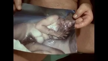 hairy